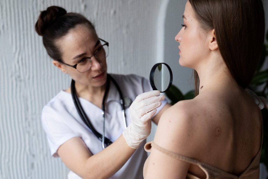 Keloid Treatment
