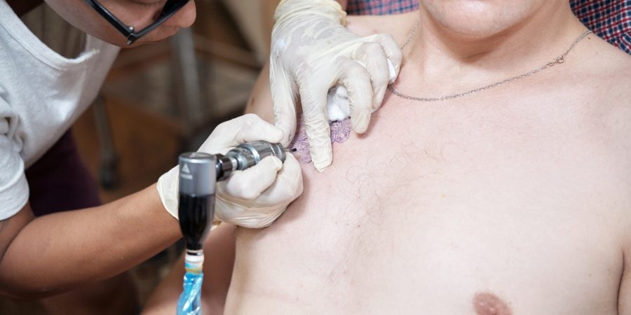 Keloid Treatment in Malaysia: Modern Solutions for Scar Management