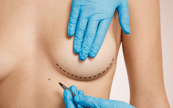 Plastic Surgery Myths vs Facts Every Patient Should Know