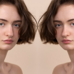 Rhinoplasty Malaysia