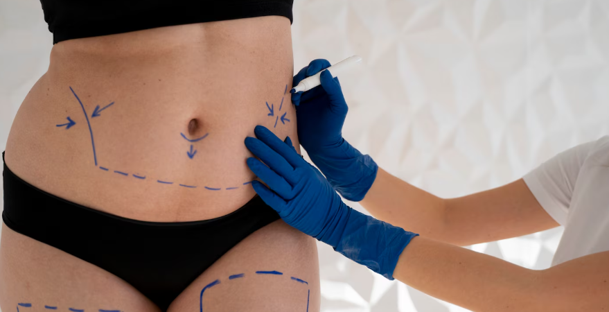 Plastic Surgery Recovery Timeline: Week-by-Week Guide